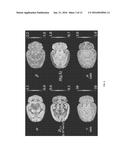 Fractional Order and Entropy Bio-Markers for Biological Tissue in     Diffusion Weighted Magnetic Resonance Imaging diagram and image