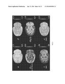 Fractional Order and Entropy Bio-Markers for Biological Tissue in     Diffusion Weighted Magnetic Resonance Imaging diagram and image