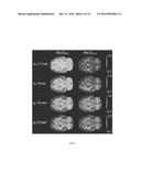 Fractional Order and Entropy Bio-Markers for Biological Tissue in     Diffusion Weighted Magnetic Resonance Imaging diagram and image