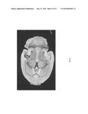 Fractional Order and Entropy Bio-Markers for Biological Tissue in     Diffusion Weighted Magnetic Resonance Imaging diagram and image