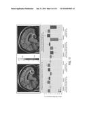 SYSTEMS AND METHODS FOR GENERATING BIOMARKERS BASED ON MULTIVARIATE     CLASSIFICATION OF FUNCTIONAL IMAGING AND ASSOCIATED DATA diagram and image