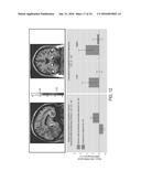 SYSTEMS AND METHODS FOR GENERATING BIOMARKERS BASED ON MULTIVARIATE     CLASSIFICATION OF FUNCTIONAL IMAGING AND ASSOCIATED DATA diagram and image