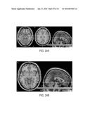 SYSTEMS AND METHODS FOR GENERATING BIOMARKERS BASED ON MULTIVARIATE     CLASSIFICATION OF FUNCTIONAL IMAGING AND ASSOCIATED DATA diagram and image