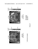 SYSTEMS AND METHODS FOR GENERATING BIOMARKERS BASED ON MULTIVARIATE     CLASSIFICATION OF FUNCTIONAL IMAGING AND ASSOCIATED DATA diagram and image