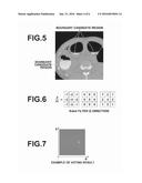 REGION EXTRACTION APPARATUS, METHOD, AND PROGRAM diagram and image