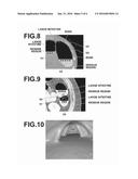 REGION EXTRACTION APPARATUS, METHOD, AND PROGRAM diagram and image