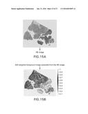 WHOLE SLIDE IMAGE REGISTRATION AND CROSS-IMAGE ANNOTATION DEVICES, SYSTEMS     AND METHODS diagram and image