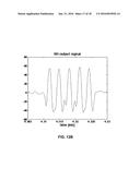 DETECTING A SERVO PATTERN USING A DATA CHANNEL IN A MAGNETIC TAPE DRIVE diagram and image