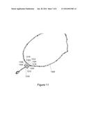 SYSTEMS AND METHODS FOR CUSTOMIZABLE, EMBELLISHMENTS diagram and image