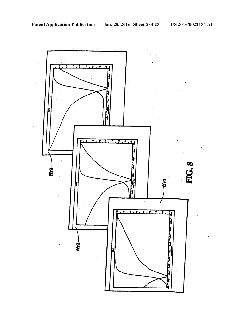 SYSTEM INCLUDING GUIDEWIRE FOR DETECTING FLUID PRESSURE - diagram, schematic, and image 06