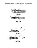 SYSTEM INCLUDING GUIDEWIRE FOR DETECTING FLUID PRESSURE diagram and image