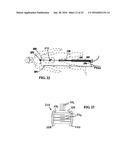 SYSTEM INCLUDING GUIDEWIRE FOR DETECTING FLUID PRESSURE diagram and image