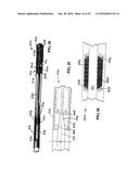 SYSTEM INCLUDING GUIDEWIRE FOR DETECTING FLUID PRESSURE diagram and image