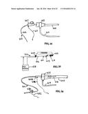 SYSTEM INCLUDING GUIDEWIRE FOR DETECTING FLUID PRESSURE diagram and image