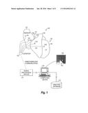 SYSTEM AND METHOD TO DEFINE DRIVERS OF SOURCES ASSOCIATED WITH BIOLOGICAL     RHYTHM DISORDERS diagram and image