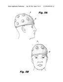 ELECTRODE ASSEMBLIES AND ELECTROENCEPHALOGRAPHS DEVICES diagram and image