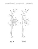 X-RAY SCATTER REDUCING DEVICE FOR USE WITH 2D AND 3D MAMMOGRAPHY diagram and image