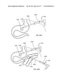 MAGNETIC ANASTOMOSIS DEVICES AND METHODS OF DELIVERY diagram and image