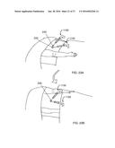 MAGNETIC ANASTOMOSIS DEVICES AND METHODS OF DELIVERY diagram and image