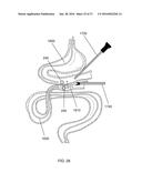 MAGNETIC ANASTOMOSIS DEVICES AND METHODS OF DELIVERY diagram and image