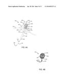 DEVICES, SYSTEMS, AND METHODS FOR INVERTING AND CLOSING THE LEFT ATRIAL     APPENDAGE diagram and image