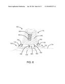 DEVICES, SYSTEMS, AND METHODS FOR INVERTING AND CLOSING THE LEFT ATRIAL     APPENDAGE diagram and image