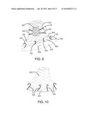 DEVICES, SYSTEMS, AND METHODS FOR INVERTING AND CLOSING THE LEFT ATRIAL     APPENDAGE diagram and image