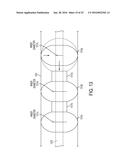 LEAD EXTRACTION METHODS AND APPARATUS diagram and image