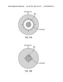 LEAD EXTRACTION METHODS AND APPARATUS diagram and image