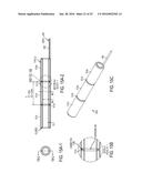 LEAD EXTRACTION METHODS AND APPARATUS diagram and image