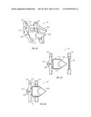 SPINOUS PROCESS FUSION DEVICES diagram and image