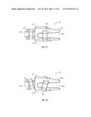 SPINOUS PROCESS FUSION DEVICES diagram and image