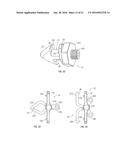 SPINOUS PROCESS FUSION DEVICES diagram and image