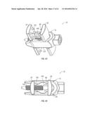 SPINOUS PROCESS FUSION DEVICES diagram and image