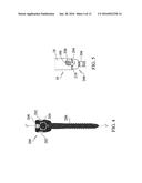 Systems, Assemblies and Methods for Spinal Derotation diagram and image