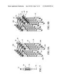 Systems, Assemblies and Methods for Spinal Derotation diagram and image