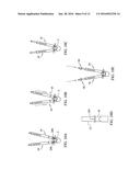 Systems, Assemblies and Methods for Spinal Derotation diagram and image