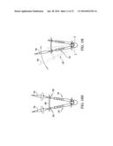 Systems, Assemblies and Methods for Spinal Derotation diagram and image