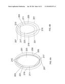 SYSTEMS AND METHODS FOR TREATING CONDITIONS AND DISEASES OF THE SPINE diagram and image