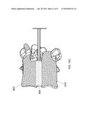 SYSTEMS AND METHODS FOR TREATING CONDITIONS AND DISEASES OF THE SPINE diagram and image