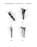 Apparatus for Humeral Fracture Repair diagram and image