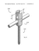 Pedicle Screw Assembly diagram and image