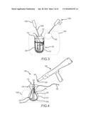 LARGE VOLUME TISSUE REDUCTION AND REMOVAL SYSTEM AND METHOD diagram and image