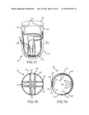 LARGE VOLUME TISSUE REDUCTION AND REMOVAL SYSTEM AND METHOD diagram and image