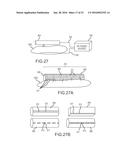 LARGE VOLUME TISSUE REDUCTION AND REMOVAL SYSTEM AND METHOD diagram and image