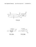 LARGE VOLUME TISSUE REDUCTION AND REMOVAL SYSTEM AND METHOD diagram and image