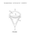 LARGE VOLUME TISSUE REDUCTION AND REMOVAL SYSTEM AND METHOD diagram and image