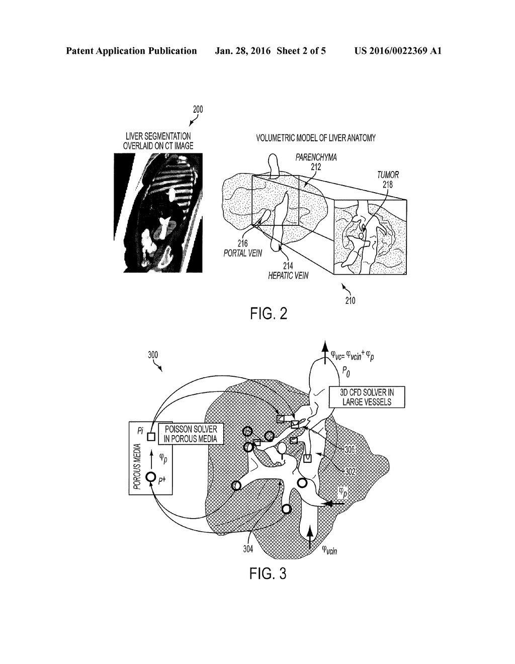 System And Method For Interactive Patient Specific Simulation Of     Radiofrequency Ablation Therapy - diagram, schematic, and image 03