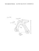 ON-BOARD TOOL TRACKING SYSTEM AND METHODS OF COMPUTER ASSISTED SURGERY diagram and image