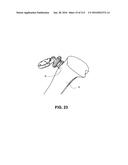 ON-BOARD TOOL TRACKING SYSTEM AND METHODS OF COMPUTER ASSISTED SURGERY diagram and image